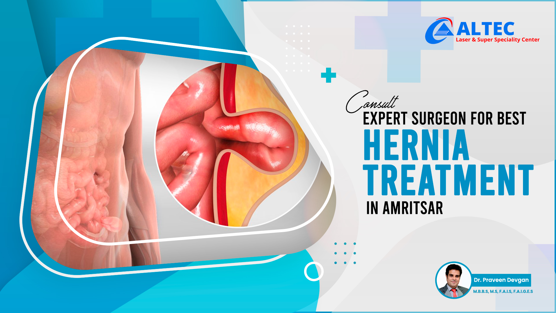 Consult Expert Surgeon for Best Hernia Treatment in Amritsar